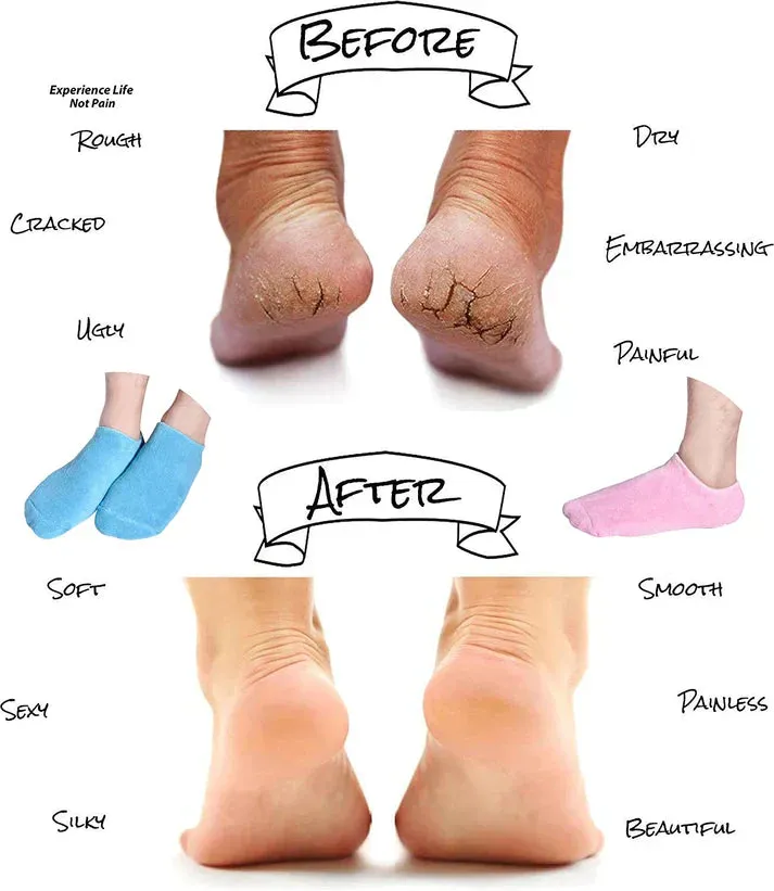 Cozy Foot Spa Silicone Socks – Winter Essential for Men & Women