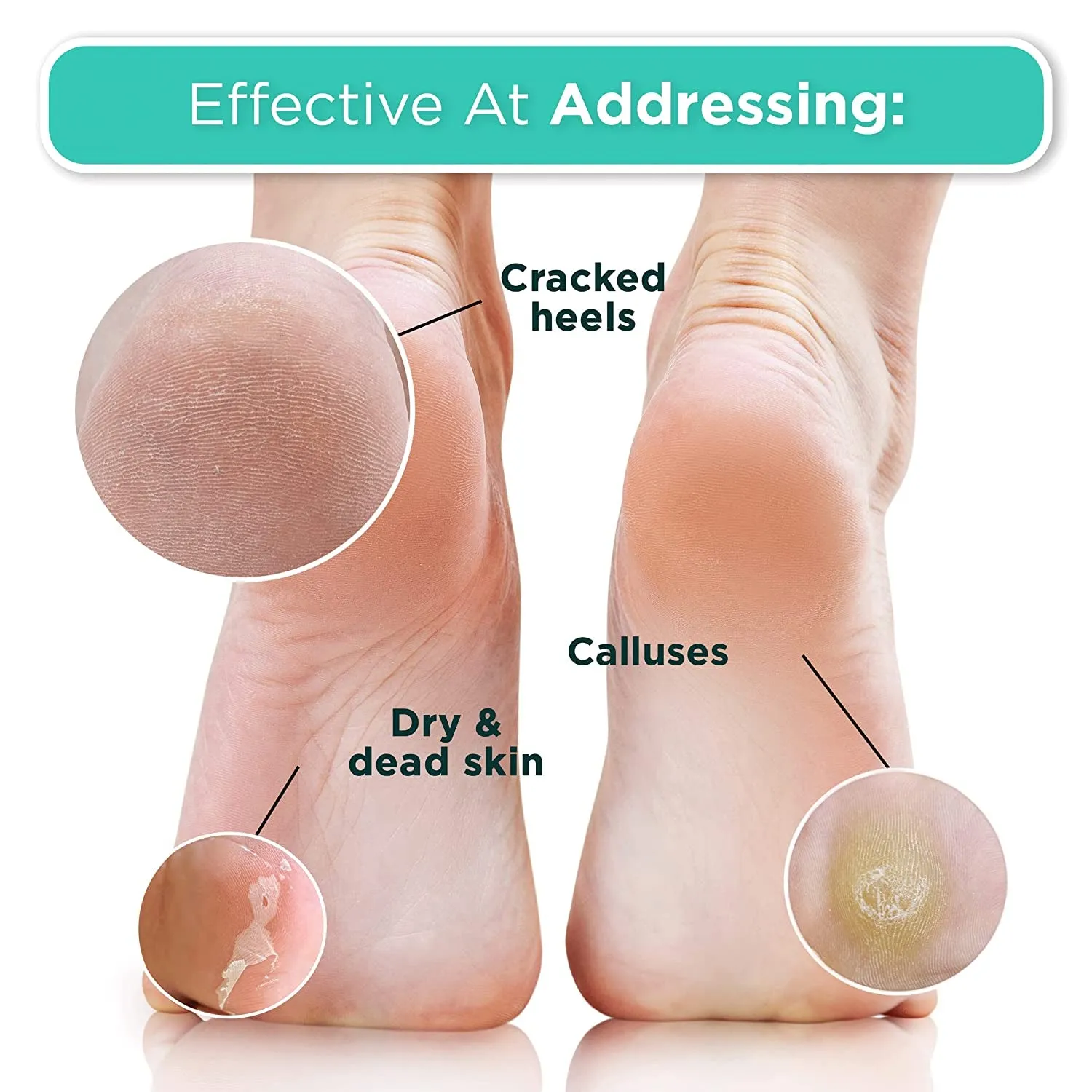 Foot Peel Mask - 4 Pack of Regular Size Skin Exfoliating Foot Masks for Dry, Cracked Feet, Callus, Dead Skin Remover for Baby Soft Feet, Original Scent