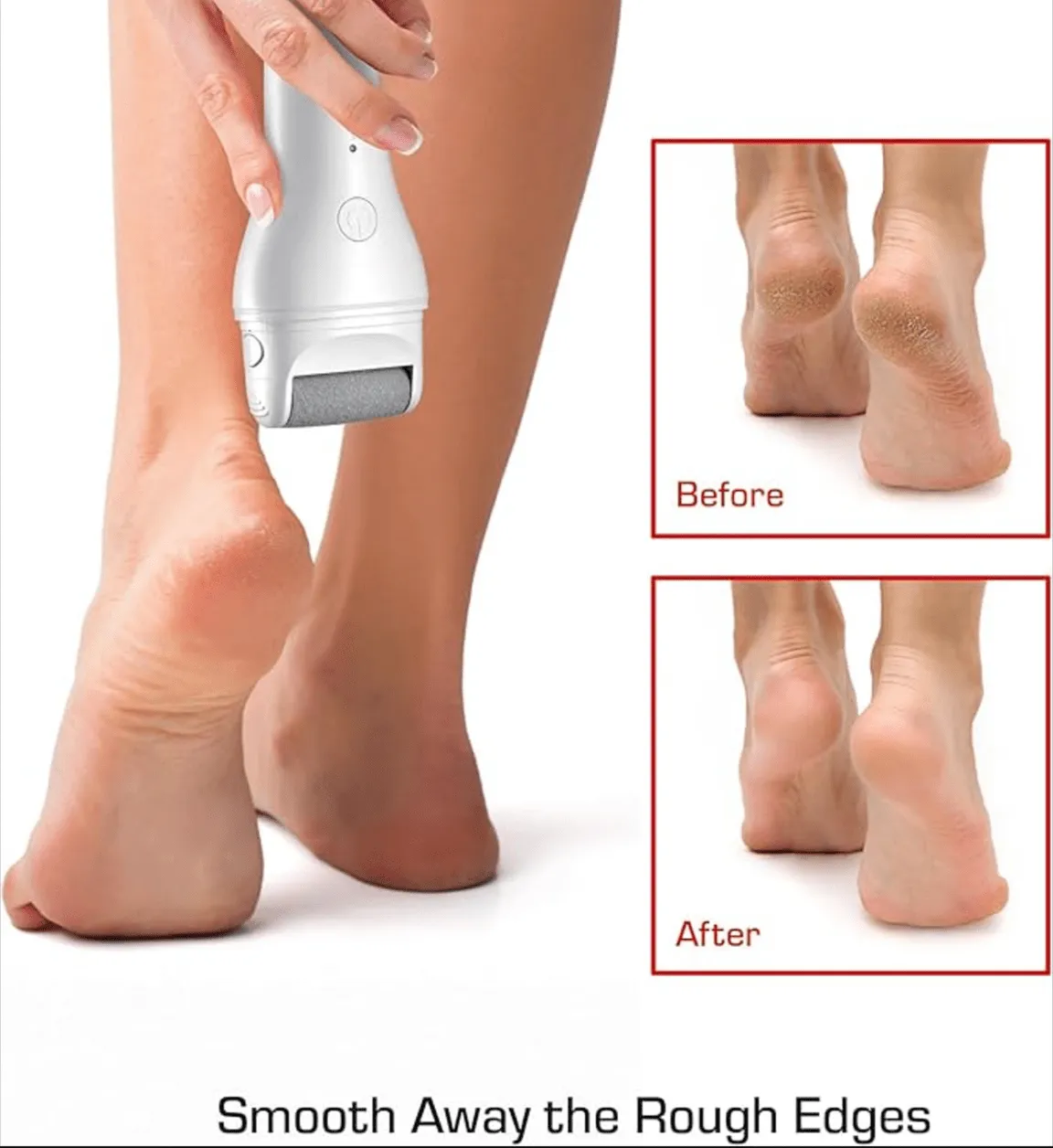 Red by Kiss Cordless Foot Callus Remover – Dual-Speed Pedicure Tool w/ 3 Rollers, Curved Head, Wet & Dry Use, 2-Hour Runtime